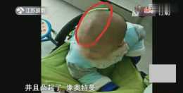 嬰兒每天23小時戴“矯正頭盔”，能養出完美頭型？