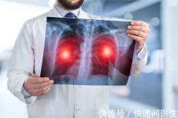 想知道“肺部”健康狀況如何？醫生：這個動作可自測，不妨試試！