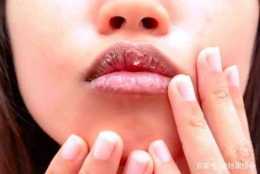 精妝聯華美妝：嘴唇乾裂脫皮怎麼辦，六個潤唇方法養護嬌嫩嘴唇