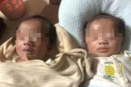早產雙胞胎小姐妹同患食管閉鎖，醫生成功“解鎖”救命