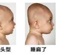 【家家母嬰】影響孩子顏值的扁頭，做好這9步就可以預防！