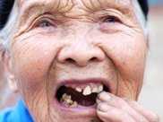 老了牙齒一定會掉光嗎教你4個妙招，80歲還一口好牙，吃嘛嘛香
