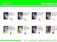 重慶銅梁惠耳助聽器：助聽器的種類和優缺點