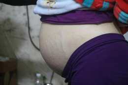 孕婦肚皮太薄，會不會被胎兒“撐破”？孕晚期別經常做這三件事