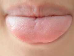 舌苔突然變得“肥厚”，還有口臭，是怎麼回事？應該怎麼調理好？