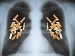 煙不離手者，晨起出現4種表現，肺或已“爛穿”，佔一個也要早查肺CT